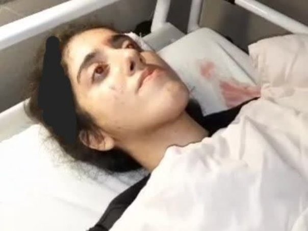 توضیح پلیس درباره ماجرای دختر ۲۰ ساله در تجمع میدان شهرداری رشت